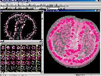 Gastrula